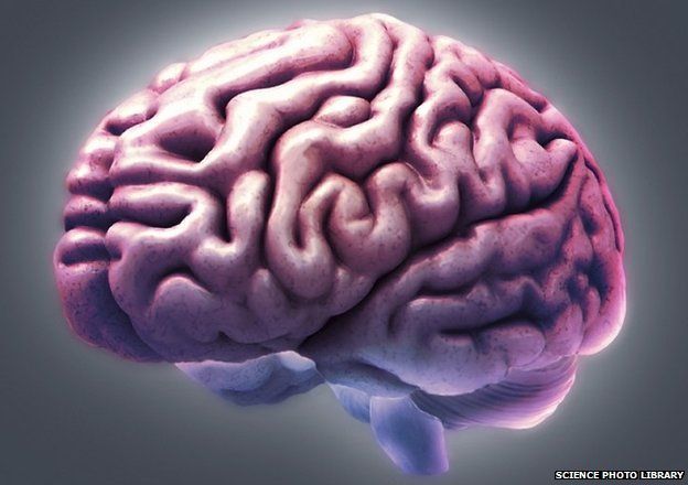 MRI scan of healthy brain