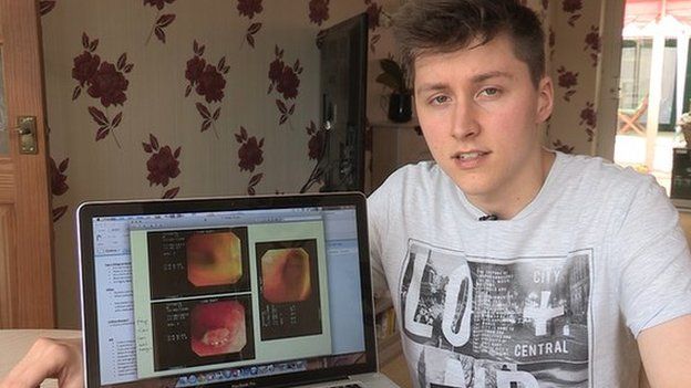 Liam Ruff with images of scans he's had for Crohn's Disease