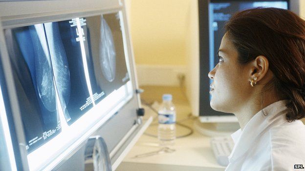 Doctor examines breast X-ray