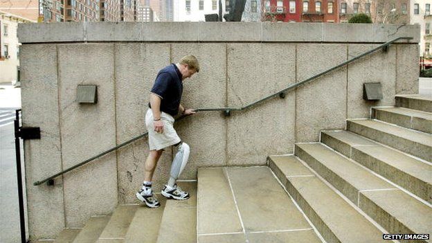 A man walking up stairs wearing one above knee prosthetic leg