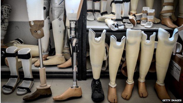 A line of prosthetic legs