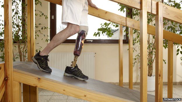 Man walking down a ramp in a below knee prosthetic