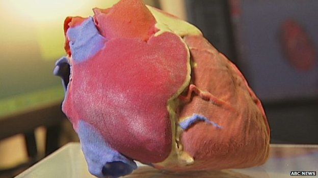 3D print of a human heart