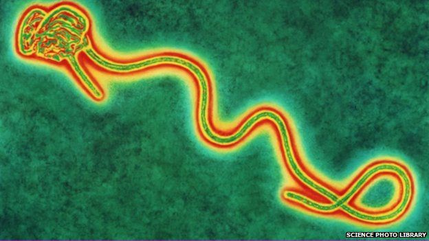 Coloured transmission electron micro graph of a single Ebola virus, the cause of Ebola fever