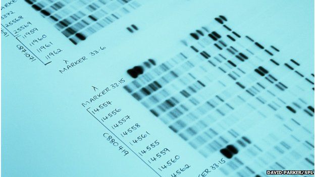 DNA autoradiograms