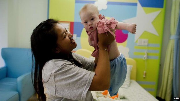 Thai surrogate mother Pattaramon Chanbua (left) holds her baby Gammy, born with Down Syndrome, at the Samitivej hospital, Sriracha district in Chonburi province, Thailand, 4 August 2014