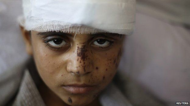 Palestinian boy Mahmoud al-Ghol