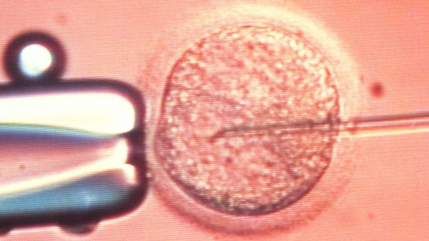 IVF treatment under a microscope