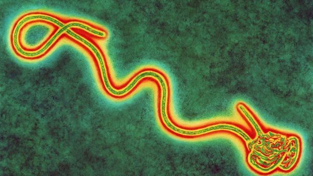 Coloured transmission electron micro graph of a single Ebola virus, the cause of Ebola fever