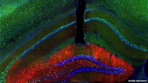 amygdala neurons
