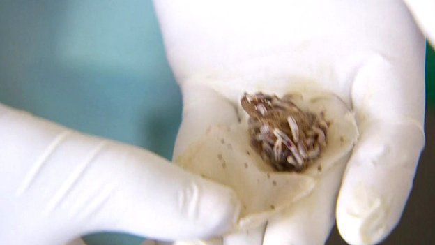 Fat larvae after being removed from a wound