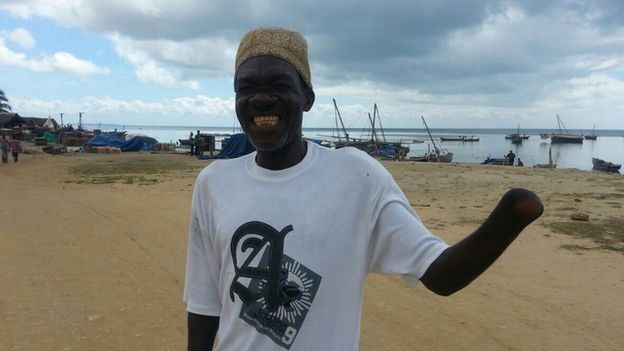 Blast fishing victim Mwanya Sleimanm, a resident of Tanzania's Mafia Island in the Indian Ocean