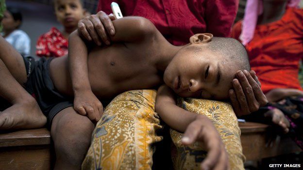 Rohingya boy suffering from malaria