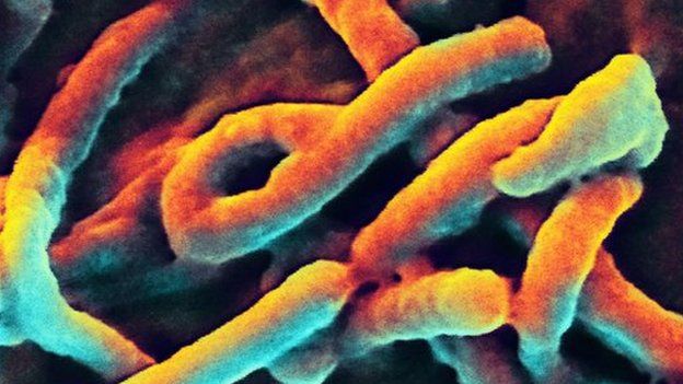 Electron micrograph image of Ebola virus