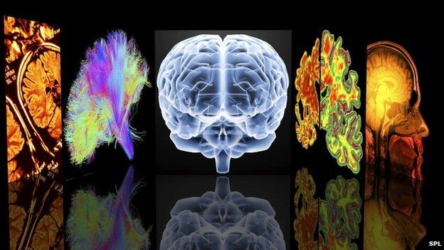 Conceptual computer artwork depicting neurology. From left to right: MRI brain scans, 3D dsi white matter brain scan, brain, Alzheimer's brain versus normal brain, MRI brain scan