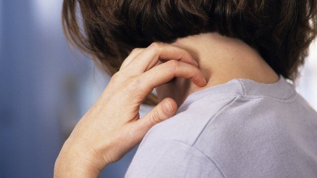 Woman with itchy neck