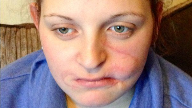Dog attack woman files compensation case against friend