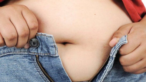 Nhs Devon Surgery Restriction For Smokers And Obese Plan Revealed Bbc News