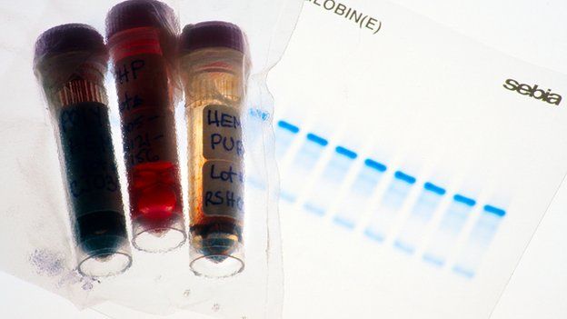 Vials of blood tested for doping purposes
