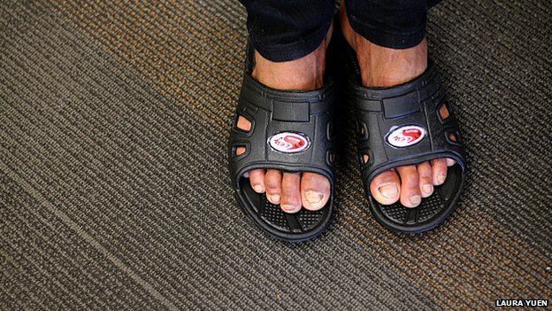 Ehsher Mu dons the flip-flops he wore before hopping on a plane from northern Thailand to Minneapolis-St. Paul, where it was 70 degrees colder
