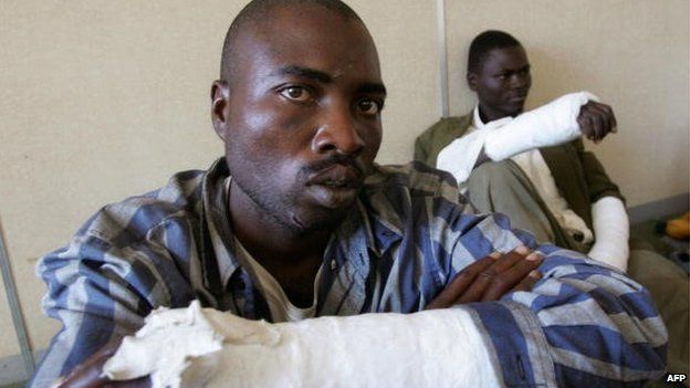 Two members of the Movement for Democratic Change (MDC) in Zimbabwe who say they were assaulted by members of the ruling party in Masvingo, south of Harare (3 May 2008)