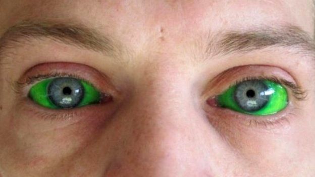 Man with blue eyes and tattooed green eyeballs