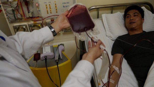 Stem Cell Donation: Rare China-UK Match - BBC News