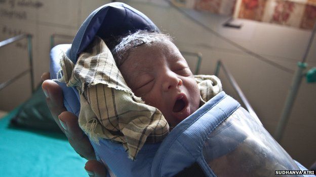 A premature baby wearing an Embrace baby warmer