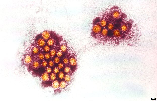 norovirus particles