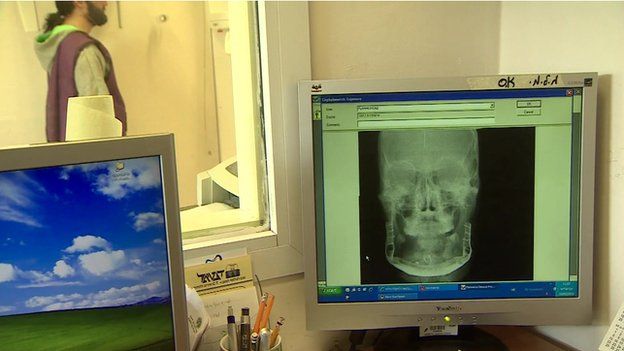 An x-ray shows the rebuilt jaw of Mohammed, a Syrian man treated by Israeli medics after being found in the Golan Heights
