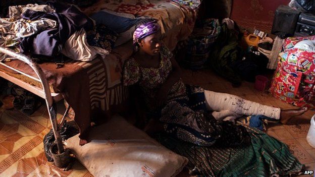 A Nigerian woman, with an injured leg sustained during her exodus from Maiduguri to the city of Kano, fleeing Boko Haram Islamists, sits in a room she shares with 78 others displaced in a run down house, in a poor district of Kano, on February 9, 2015