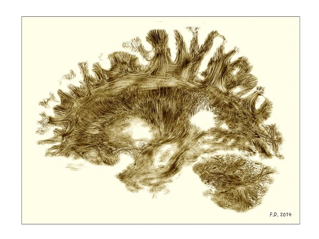 Mapping brain wiring - by Dr Flavio Dell’Acqua