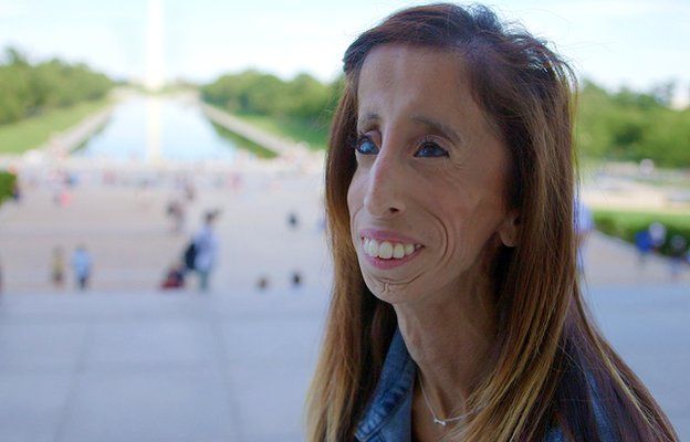 Lizzie Velasquez Online Bullies Called Me The World s Ugliest Woman 