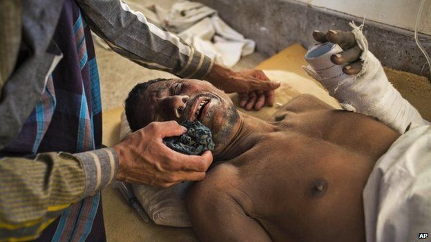 One worker receives treatment after Bangladesh building collapse - March 12, 2015
