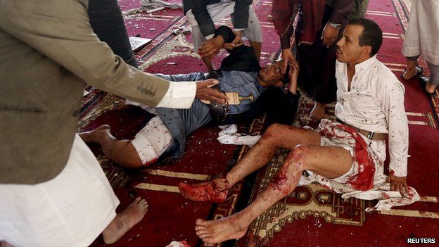 Wounded worshippers after suicide bombing at a mosque in Sanaa (20 March 2015)