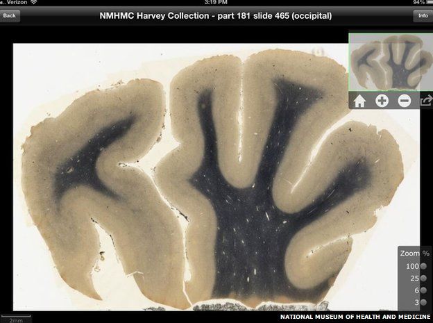 A screenshot from the Einstein brain app