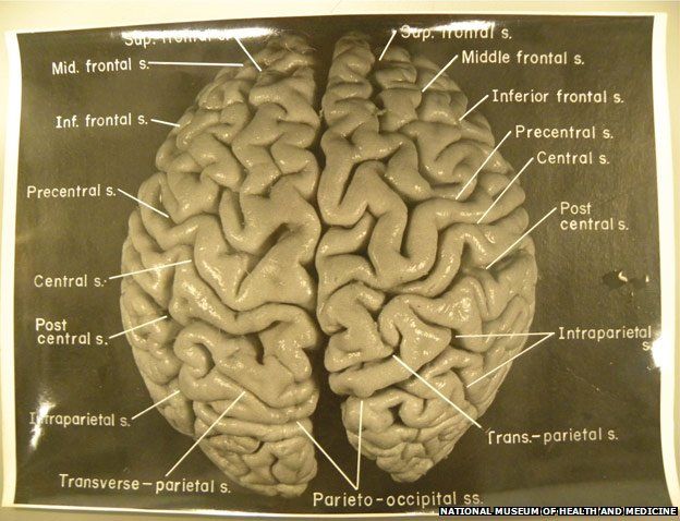 Original photos of Einstein's brain