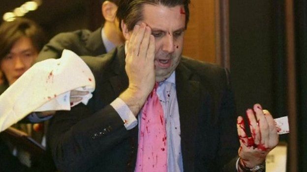 Mark Lippert bloodied from the attack