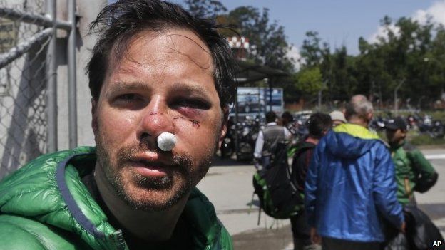 U.S. citizen Michael Churton, 38, from New York, who was injured during an avalanche resulting from Saturday’s earthquake at the base camp of the mount Everest, arrives at the domestic airport in Kathmandu, Nepal, Monday, April 27, 2015.