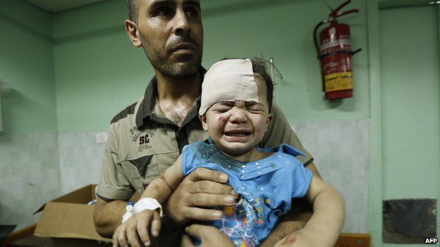 A wounded Palestinian child is treated in hospital after a reported Israeli strike on a compound housing a UN school in the Jabaliya refugee camp, Gaza (30 June 2014)