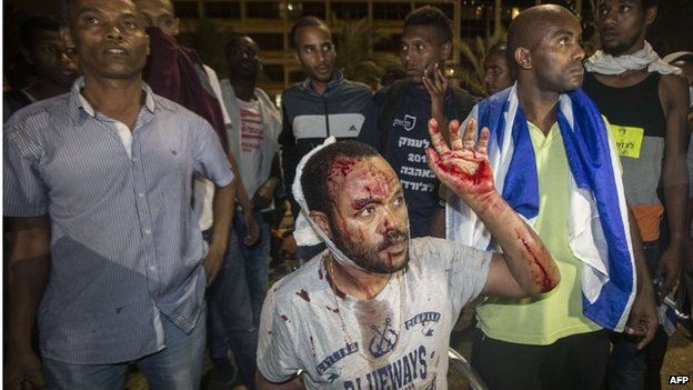 Wounded Ethiopian Israeli