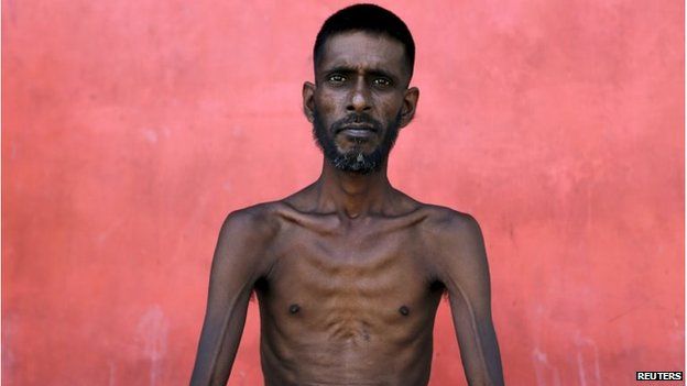 A rescued Bangladeshi migrant Kuala Langsa, in Indonesia's Aceh Province (19 May 2015)
