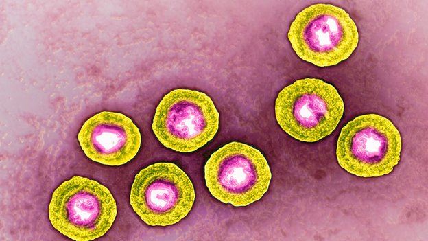 herpes simplex 1 virus