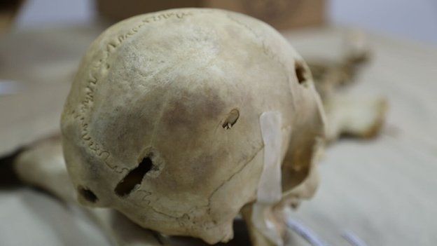 A skull in the Institute of Legal Medicine in San Salvador