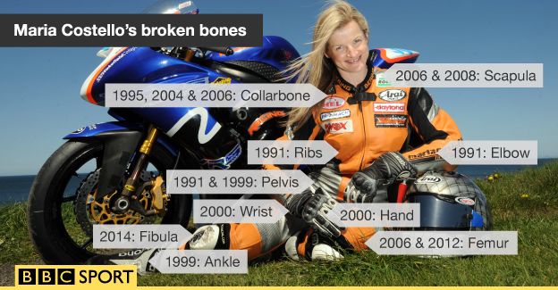 Graphic showing Maria Costello's broken bones