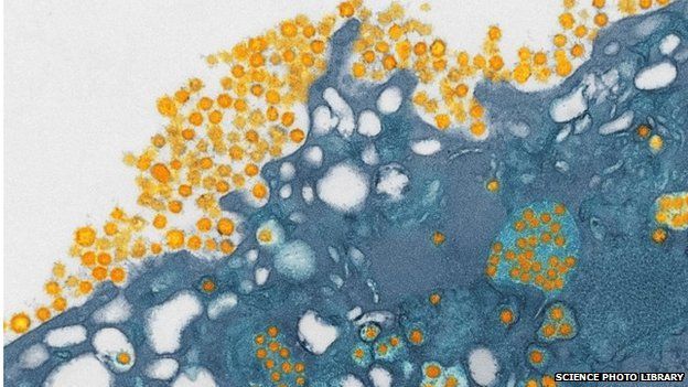 MERS coronavirus. Coloured transmission electron micrograph (TEM) of MERS coronavirus particles (orange) budding from a host cell (blue). This virus (originally novel coronavirus 2012) has been named Middle East respiratory syndrome (MERS) coronavirus.
