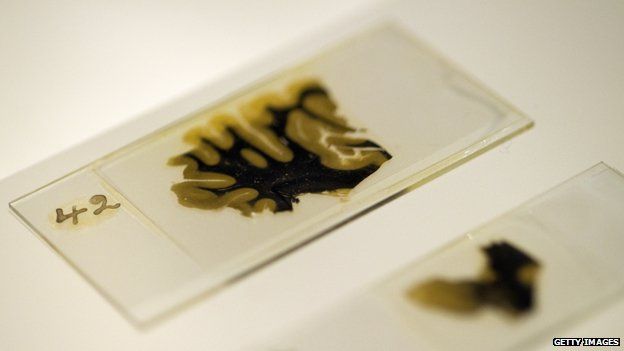 Slides of Einstein's brain on display at London's Wellcome Collection, 2012