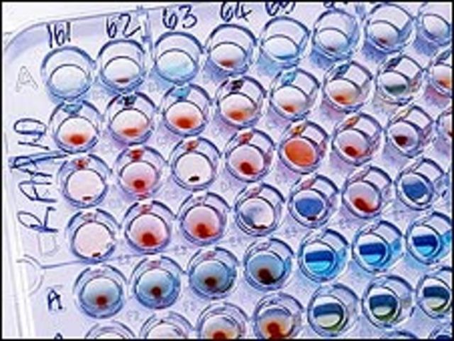 Prueba de laboratorio