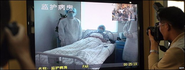 Un paciente con grip porcina en China