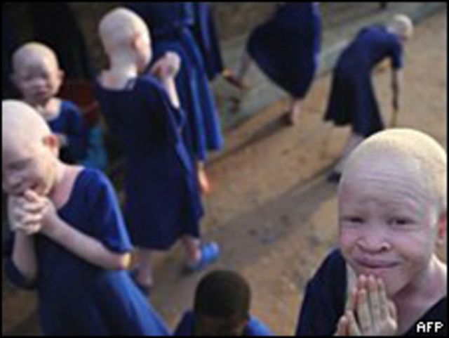 Albinos en África
